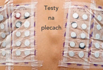 testy płatkowe dermatolog